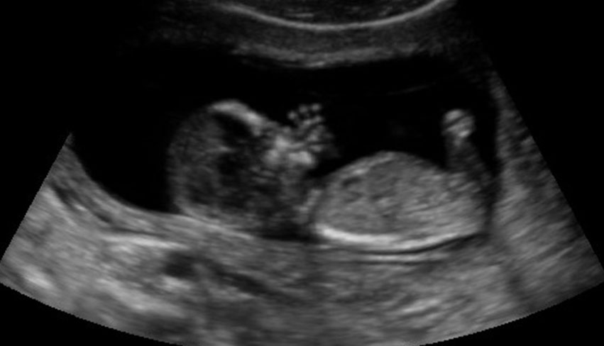 1st trimester