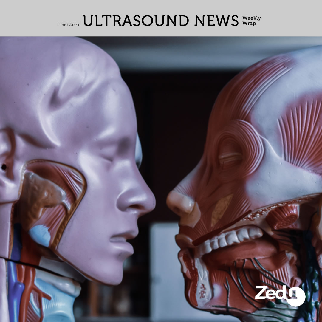 The Zedu weekly wrap - bringing together the best in free ultrasound news, views and opinions from across the internet.