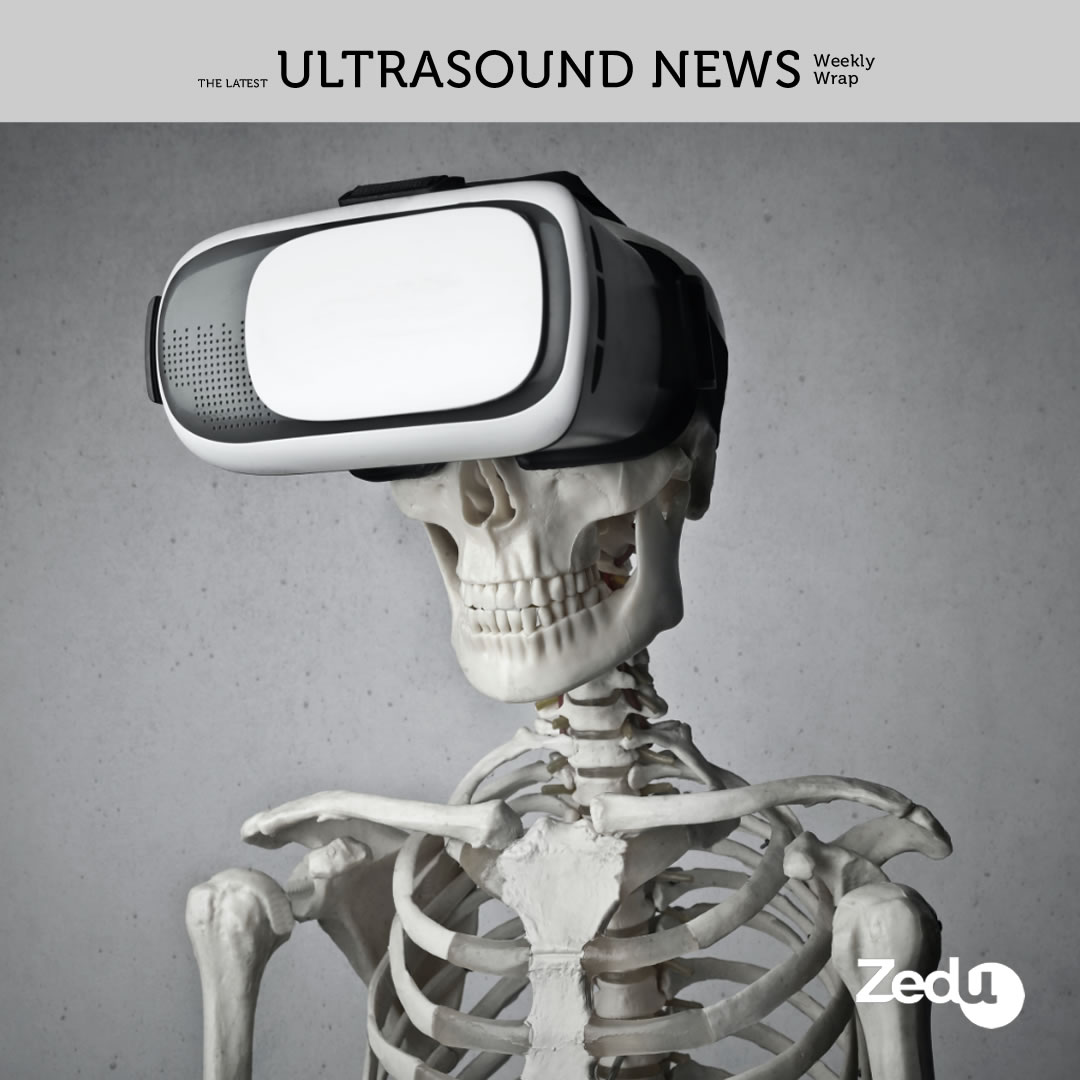 The Zedu weekly wrap - bringing together the best in free ultrasound news, views and opinions from across the internet.