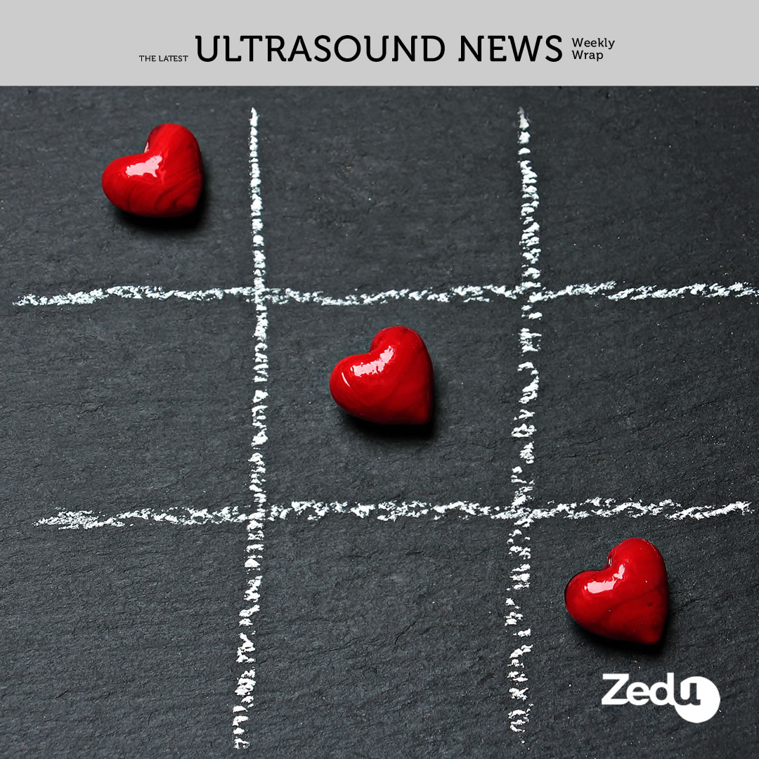 The Zedu weekly wrap - bringing together the best in free ultrasound news, views and opinions from across the internet.
