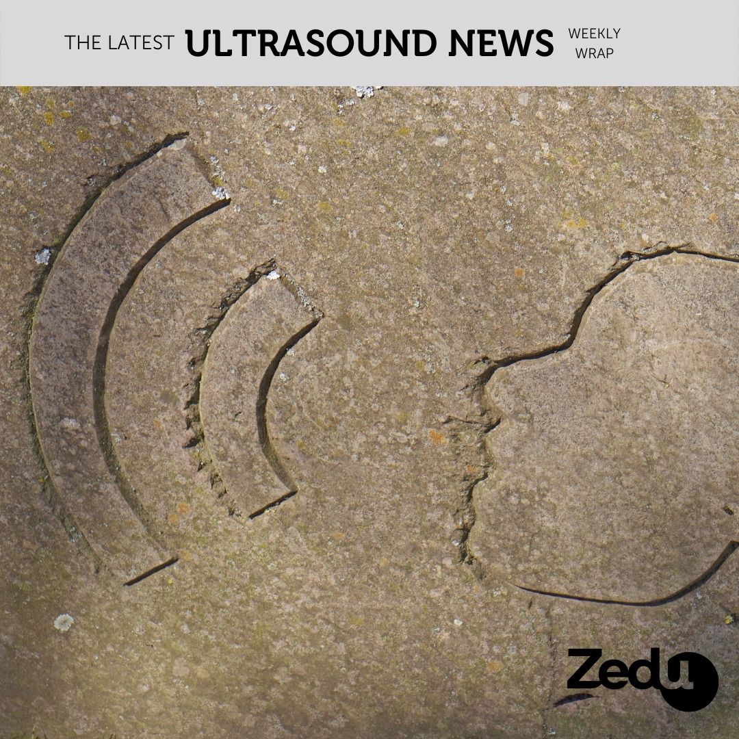 The Zedu weekly wrap - bringing together the best in free ultrasound news, views and opinions from across the internet.