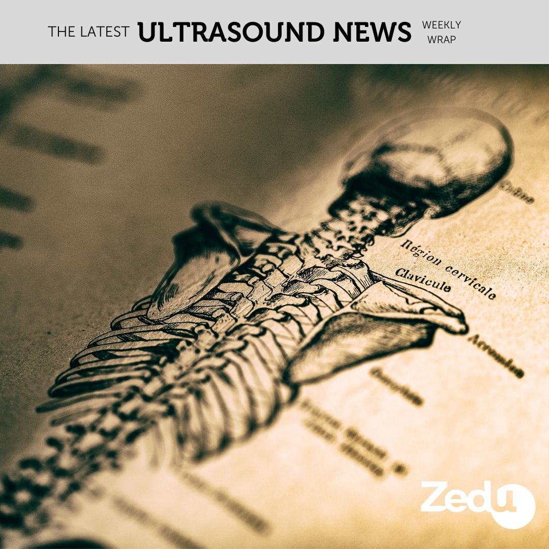 The Zedu weekly wrap - bringing together the best in free ultrasound news, views and opinions from across the internet.