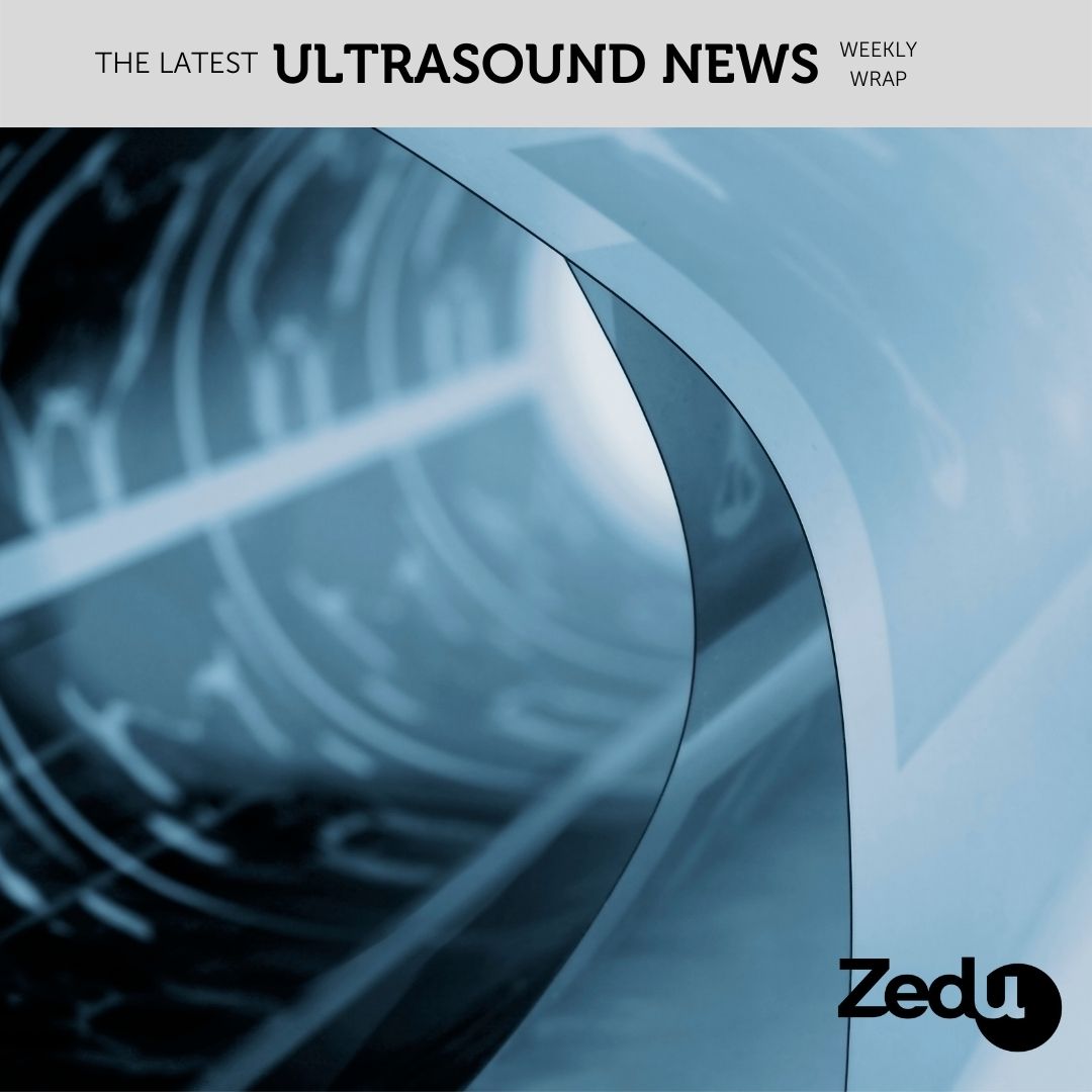 The Zedu weekly wrap - bringing together the best in free ultrasound news, views and opinions from across the internet.