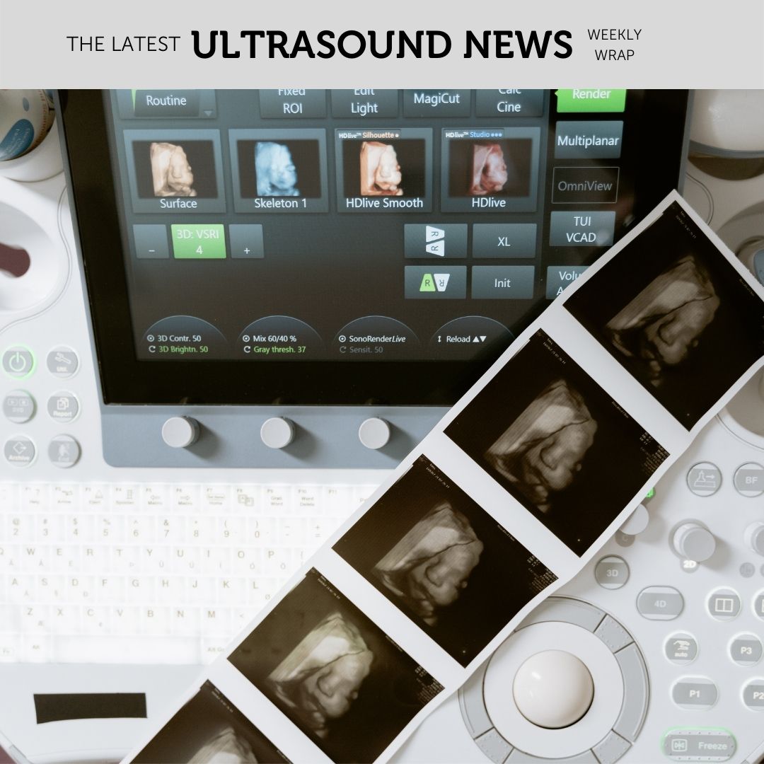 The Zedu weekly wrap - bringing together the best in free ultrasound news, views and opinions from across the internet.