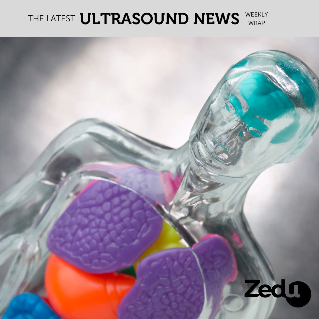 The Zedu weekly wrap - bringing together the best in free ultrasound news, views and opinions from across the internet.