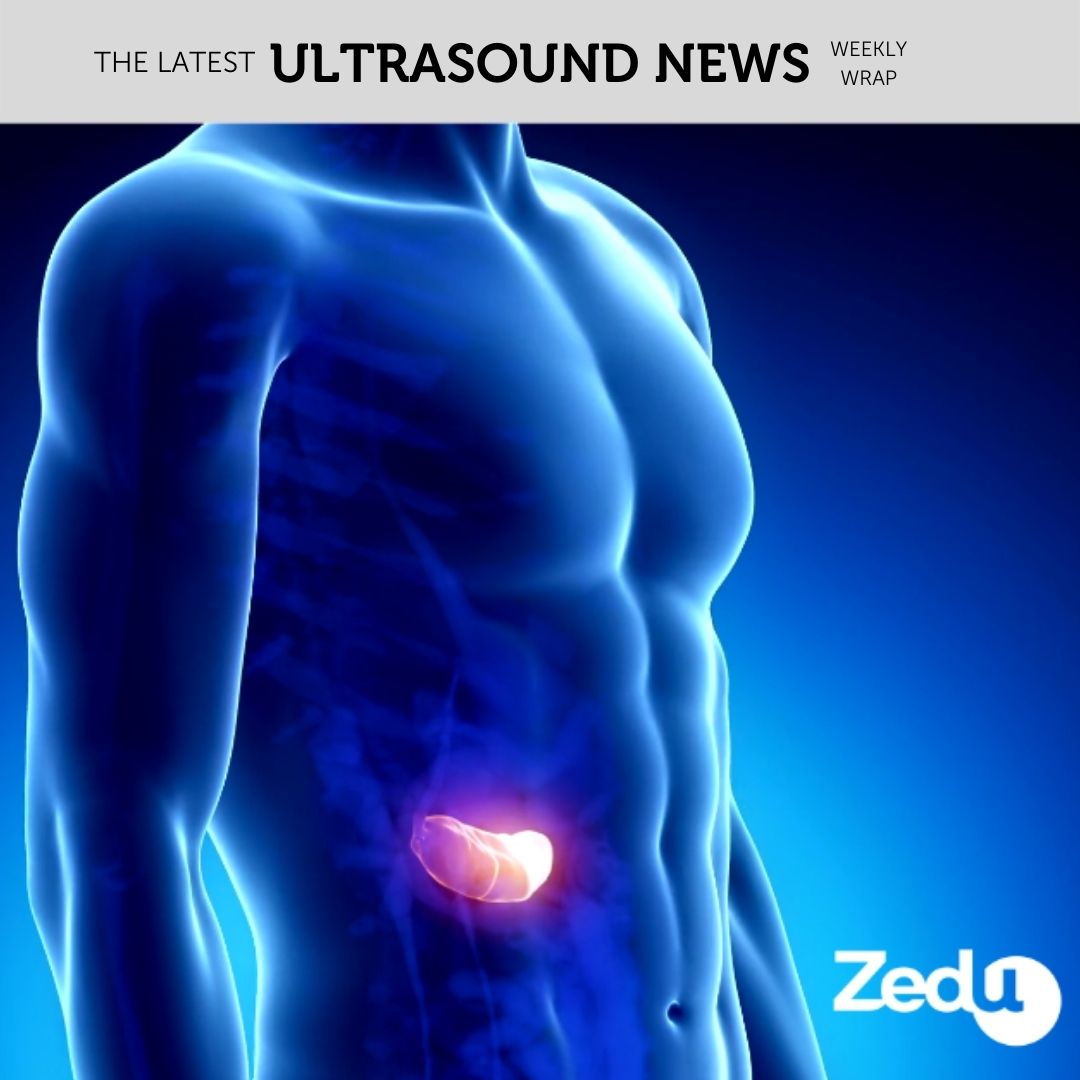 The Zedu weekly wrap - bringing together the best in free ultrasound news, views and opinions from across the internet.