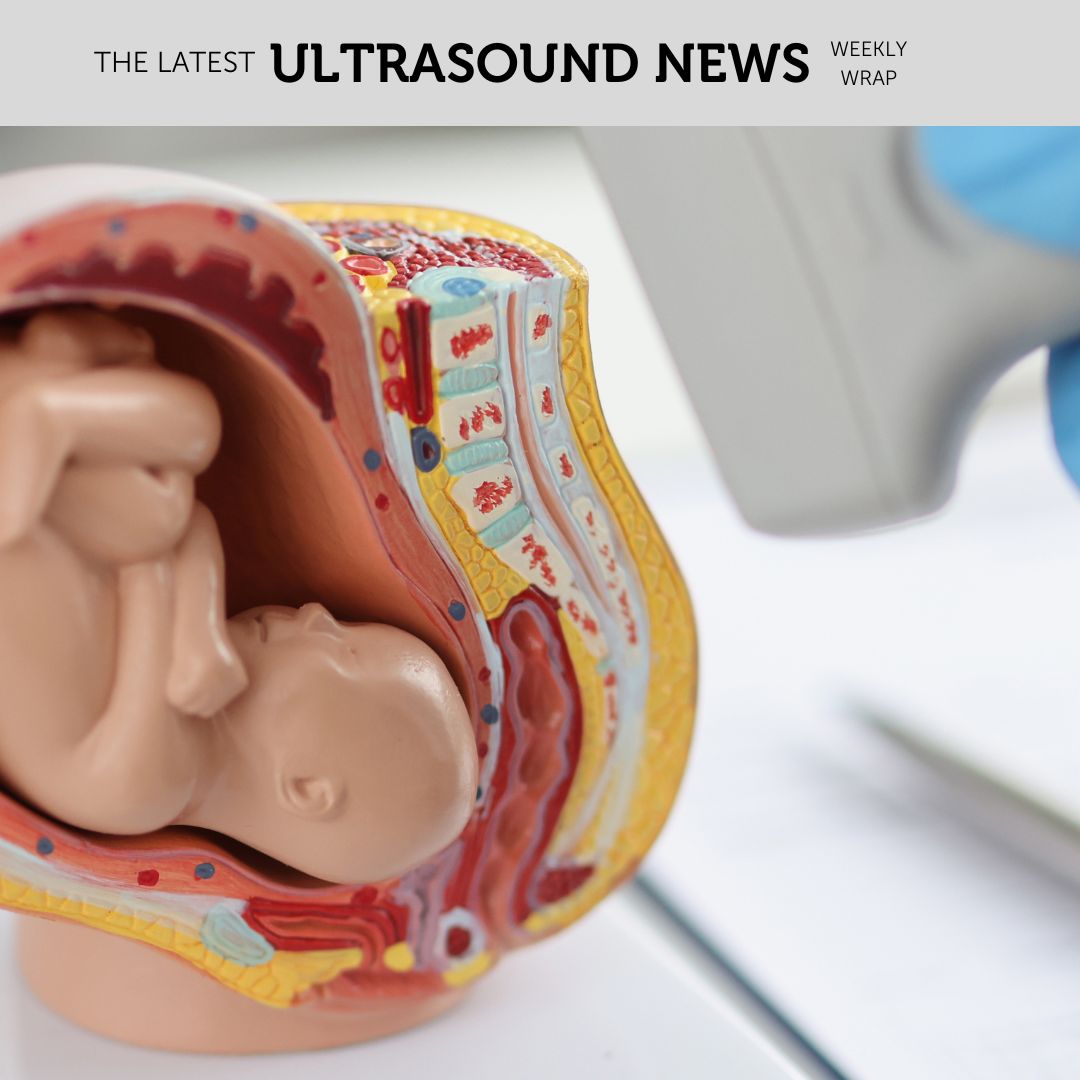 The Zedu weekly wrap - bringing together the best in free ultrasound news, views and opinions from across the internet.