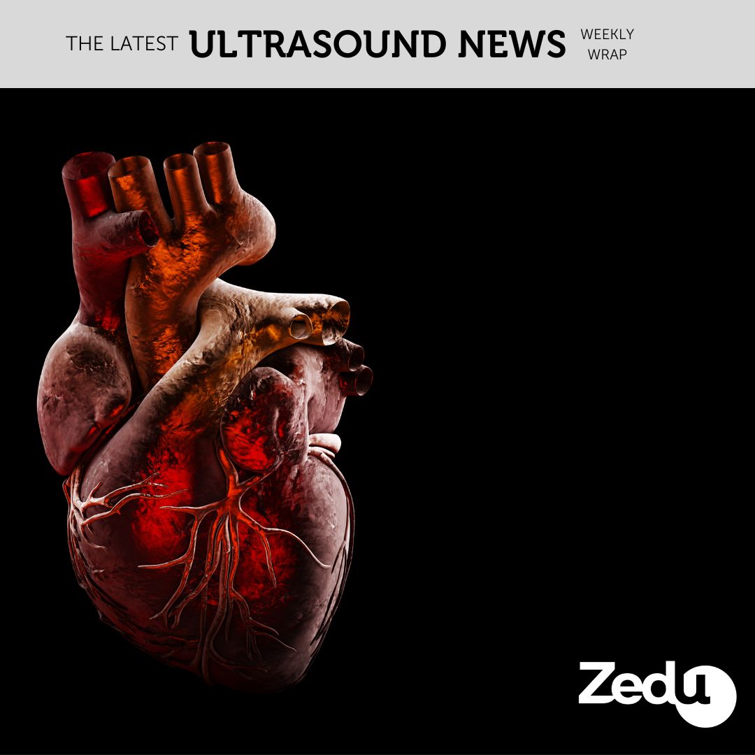 The Zedu weekly wrap - bringing together the best in free ultrasound news, views and opinions from across the internet.