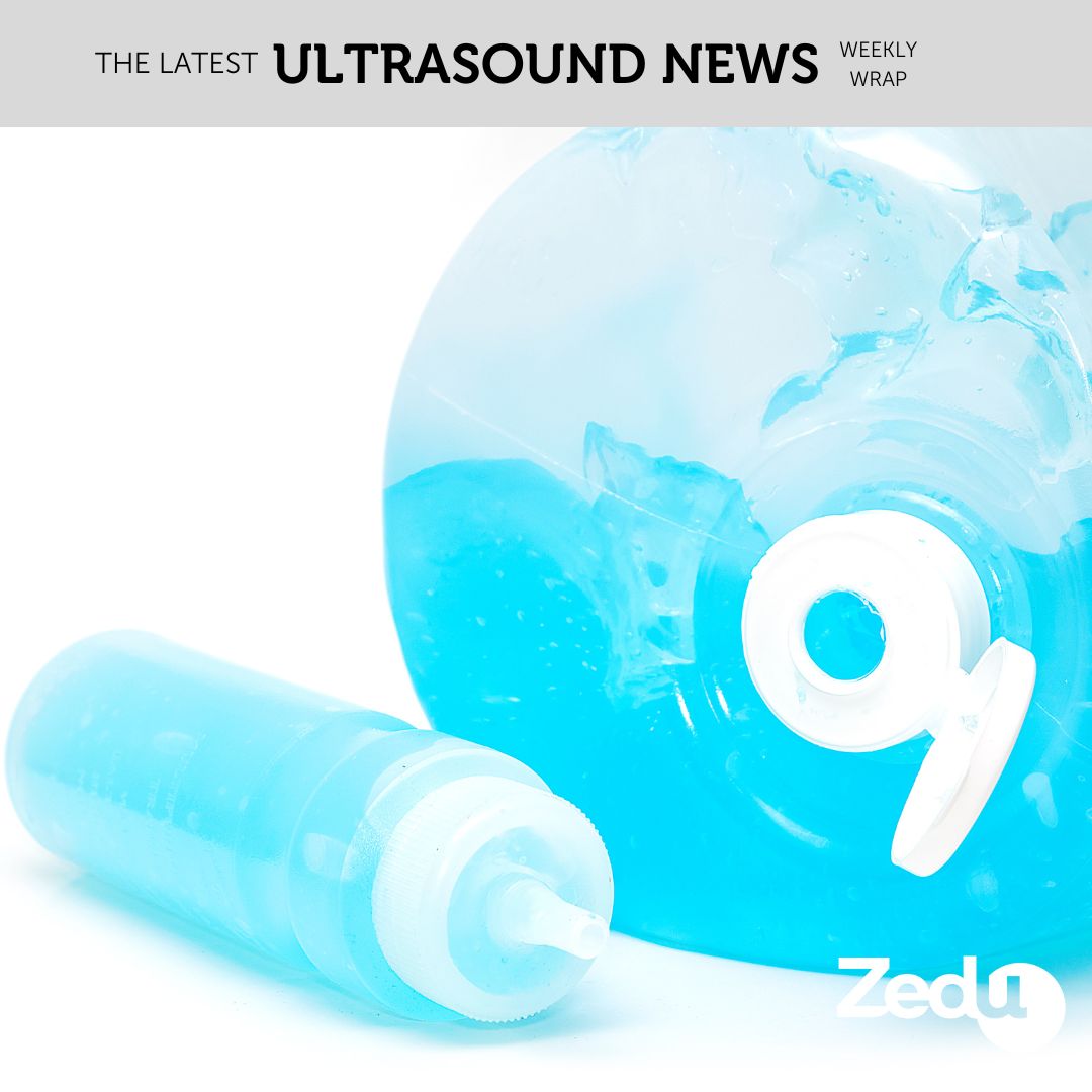 The Zedu weekly wrap - bringing together the best in free ultrasound news, views and opinions from across the internet.