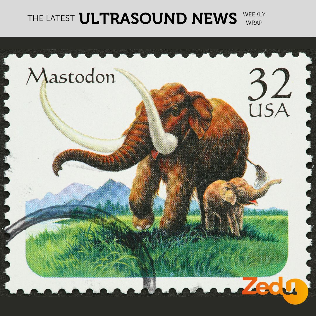 The Zedu weekly wrap - bringing together the best in free ultrasound news, views and opinions from across the internet.