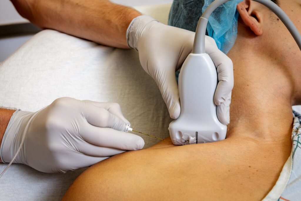Regional anaesthesia nerve block
