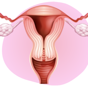Gynaecology Ultrasound for Sonographers