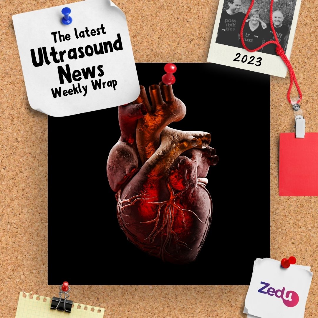The Zedu weekly wrap - bringing together the best in free ultrasound news, views and opinions from across the internet.