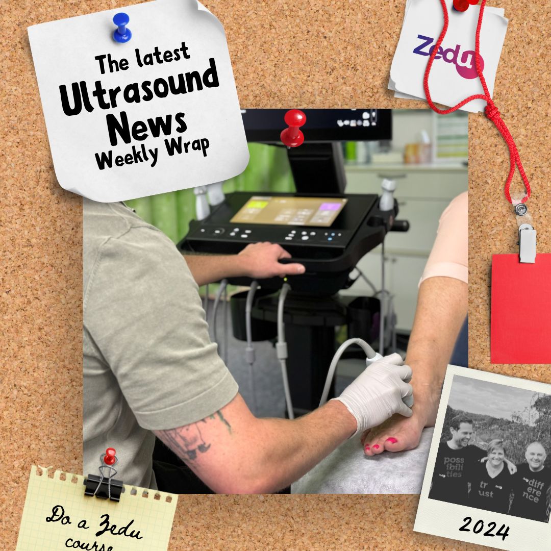 The Zedu weekly wrap - bringing together the best in free ultrasound news, views and opinions from across the internet.