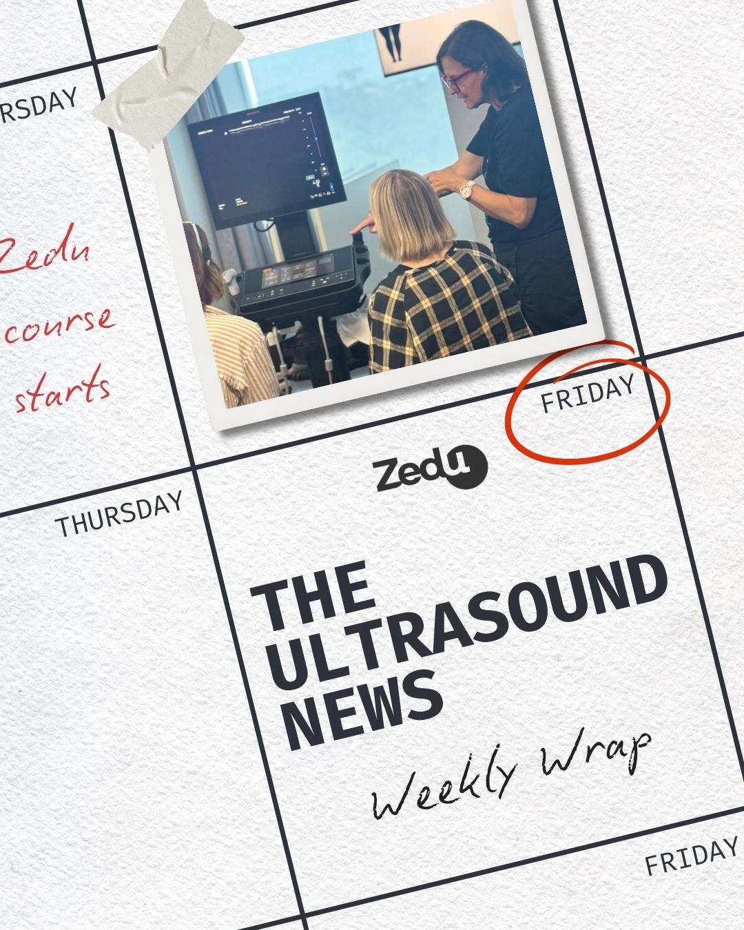 The Zedu weekly wrap - bringing together the best in free ultrasound news, views and opinions from across the internet.