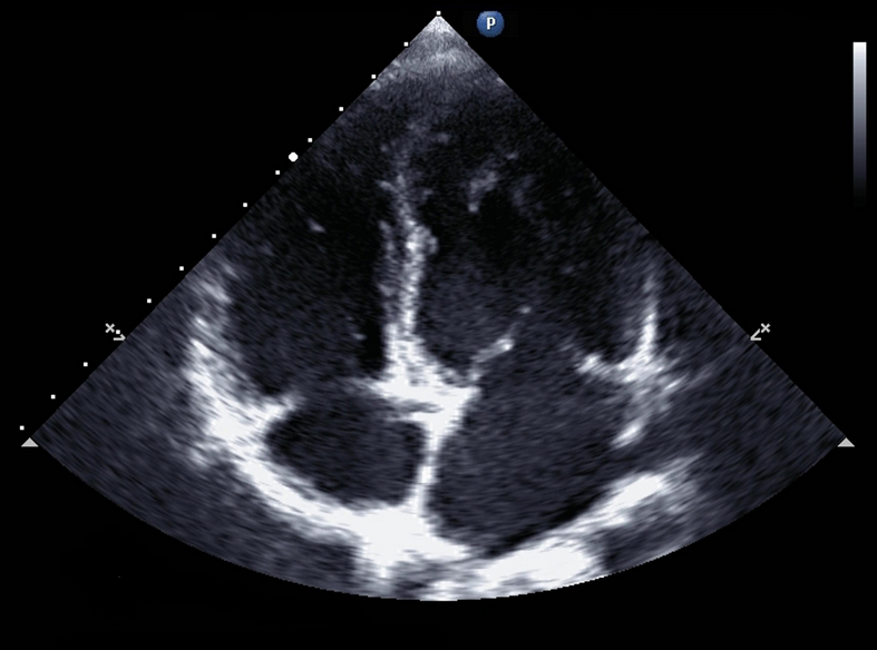 Why is learning ultrasound so important Why is learning ultrasound so important