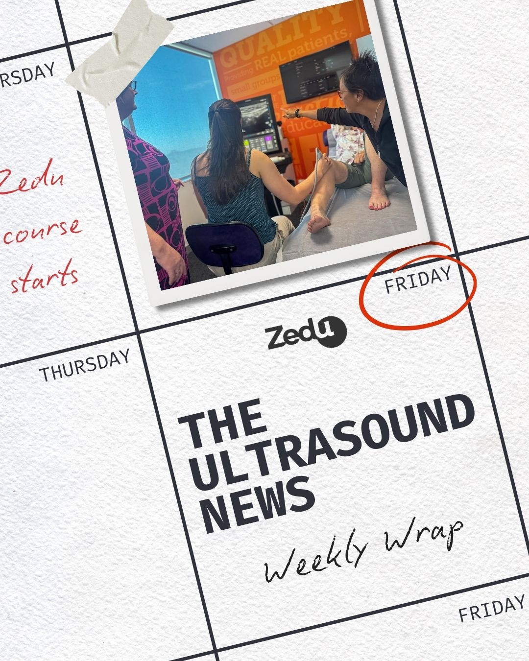 The Zedu weekly wrap - bringing together the best in free ultrasound news, views and opinions from across the internet.