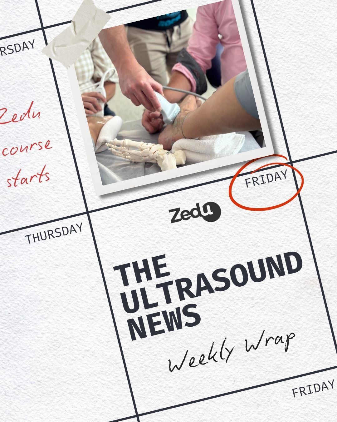 The Zedu weekly wrap - bringing together the best in free ultrasound news, views and opinions from across the internet.