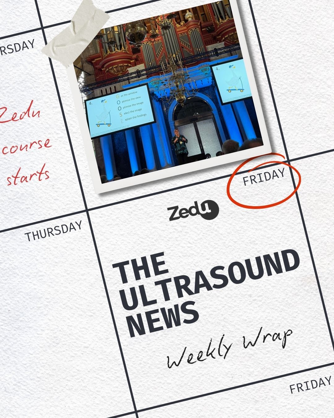 The Zedu weekly wrap - bringing together the best in free ultrasound news, views and opinions from across the internet.