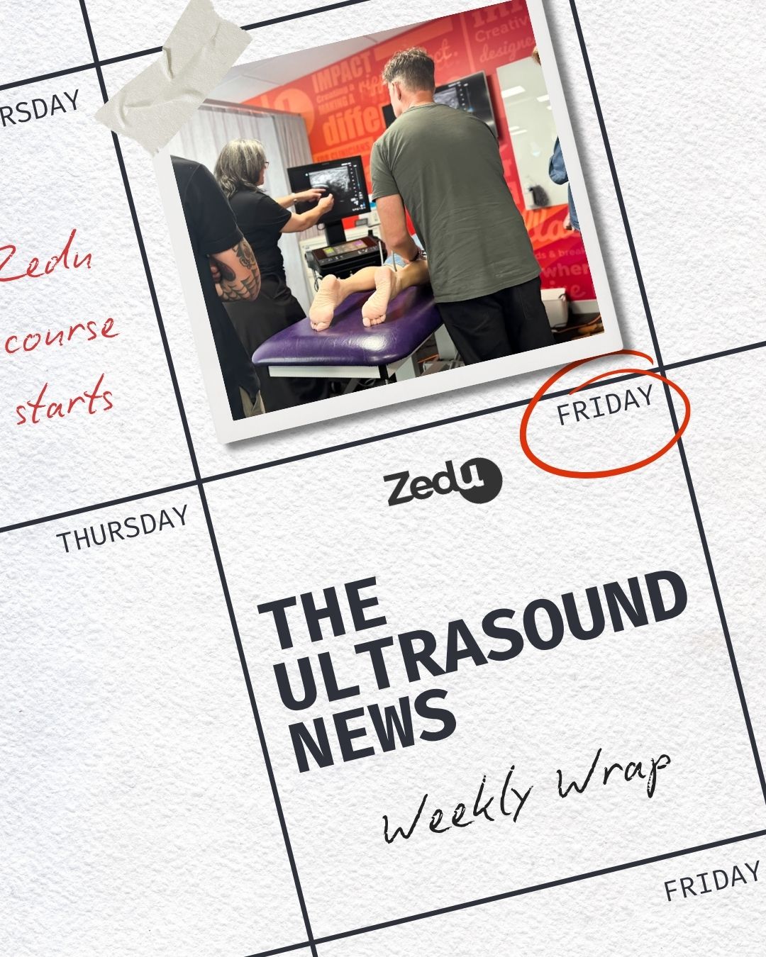 The Zedu weekly wrap - bringing together the best in free ultrasound news, views and opinions from across the internet.