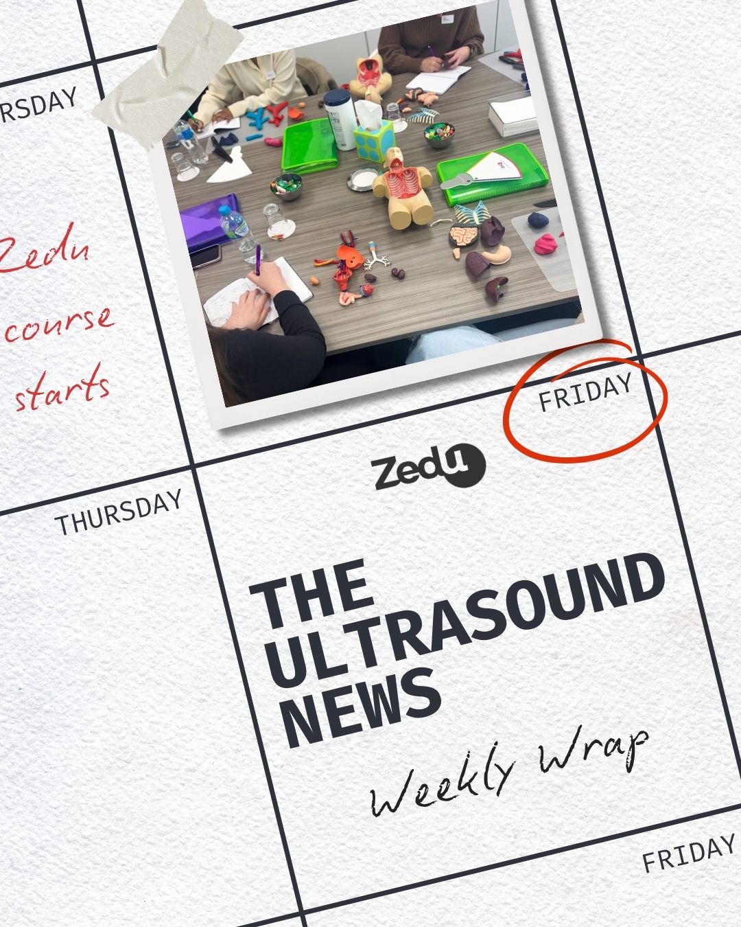 The Zedu weekly wrap - bringing together the best in free ultrasound news, views and opinions from across the internet.